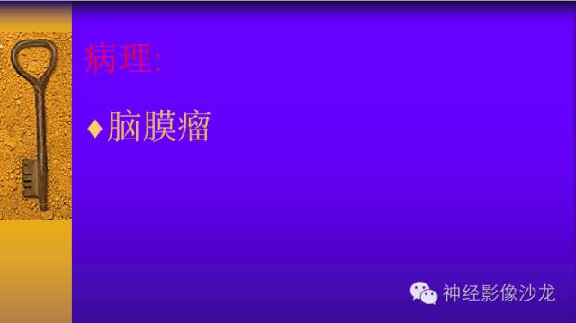 【病例】鞍旁肿瘤三例CT及MR影像表现