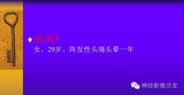【病例】鞍旁肿瘤三例CT及MR影像表现