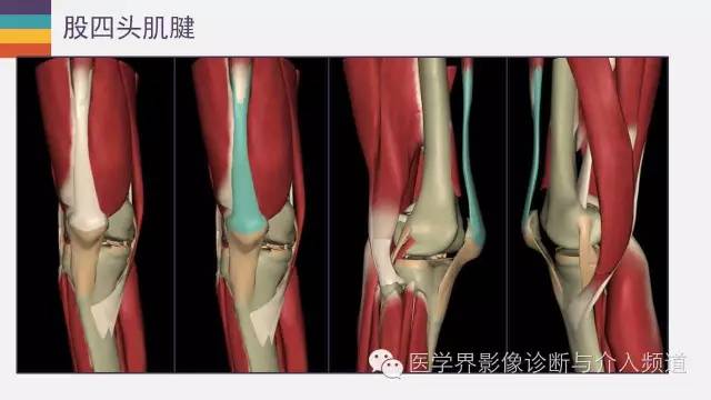 【PPT】膝关节周围肌腱解剖及MR表现