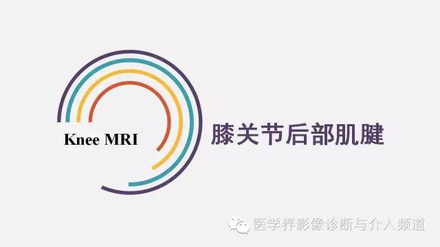 【PPT】膝关节周围肌腱解剖及MR表现