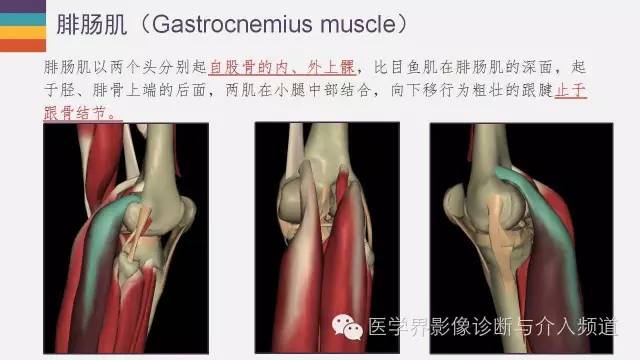 【PPT】膝关节周围肌腱解剖及MR表现