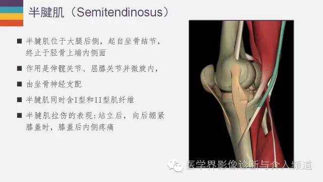 【PPT】膝关节周围肌腱解剖及MR表现