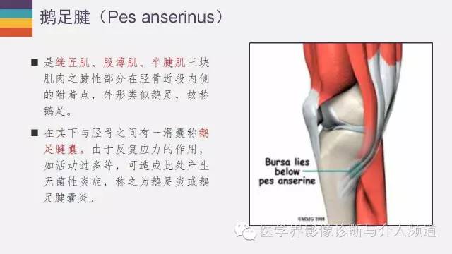 【PPT】膝关节周围肌腱解剖及MR表现