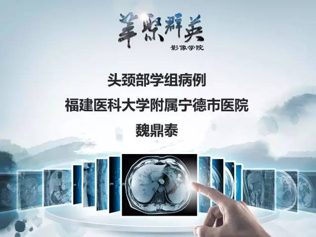 【病例】蝶骨软骨粘液样纤维瘤1例CT及MR影像表现