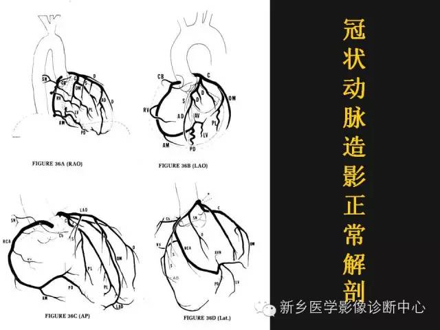 【PPT】冠状动脉造影解剖