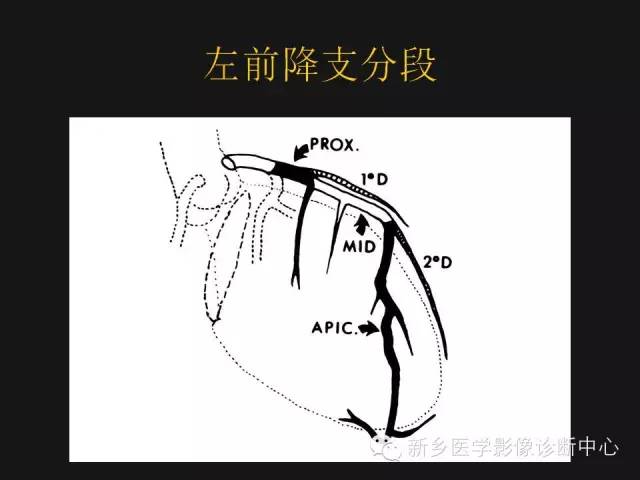 【PPT】冠状动脉造影解剖