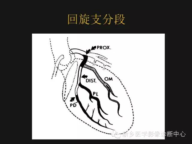 【PPT】冠状动脉造影解剖