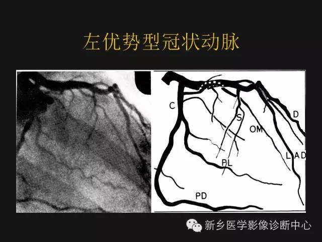 【PPT】冠状动脉造影解剖