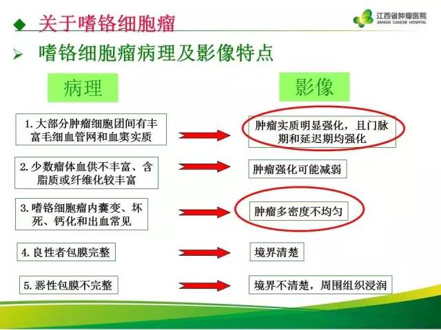 【病例】腹膜后异位嗜铬细胞瘤1例CT影像分析