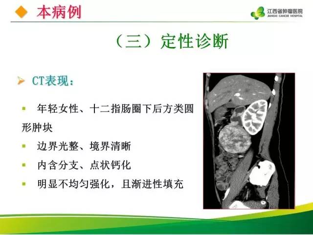【病例】腹膜后巨淋巴增生症1例CT影像表现