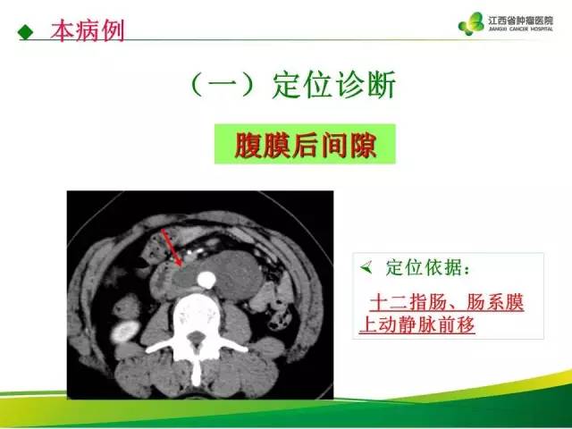 【病例】腹膜后神经鞘瘤1例CT影像表现