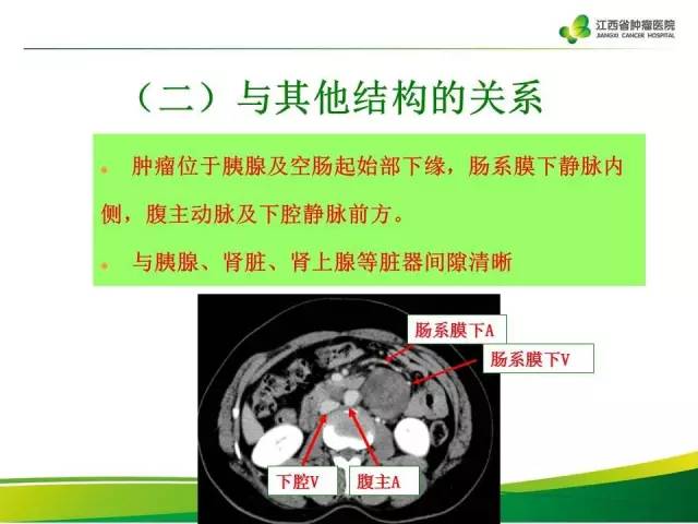 【病例】腹膜后神经鞘瘤1例CT影像表现