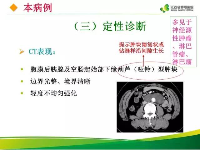 【病例】腹膜后神经鞘瘤1例CT影像表现