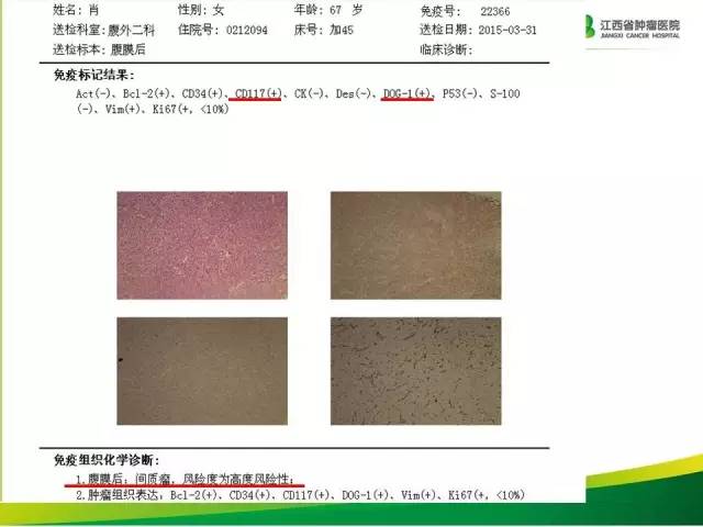 【病例】腹膜后胃肠道间质瘤1例CT影像表现
