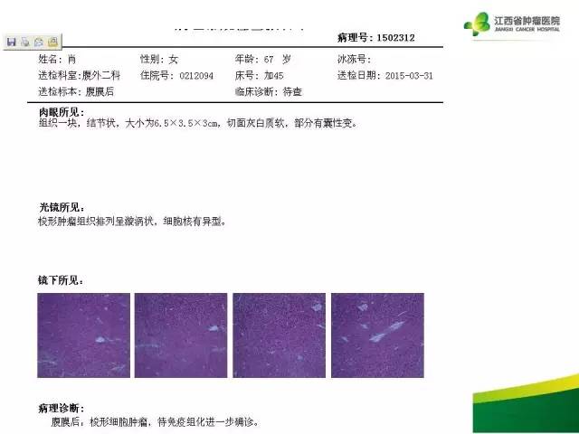 【病例】腹膜后胃肠道间质瘤1例CT影像表现