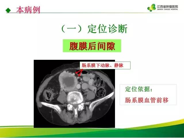 【病例】腹膜后胃肠道间质瘤1例CT影像表现