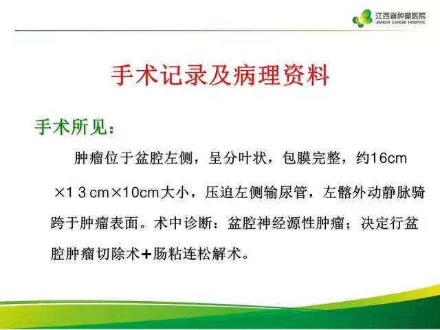 【病例】腹膜后脂肪肉瘤1例CT影像分析
