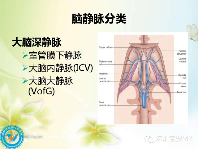 【PPT】颅内静脉系统影像CT,MRI及DSA解剖