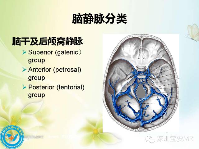 【PPT】颅内静脉系统影像CT,MRI及DSA解剖