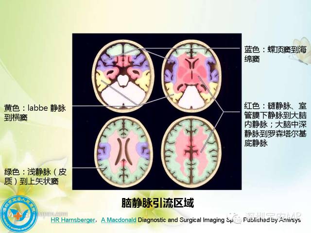 【PPT】颅内静脉系统影像CT,MRI及DSA解剖