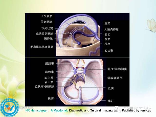 【PPT】颅内静脉系统影像CT,MRI及DSA解剖