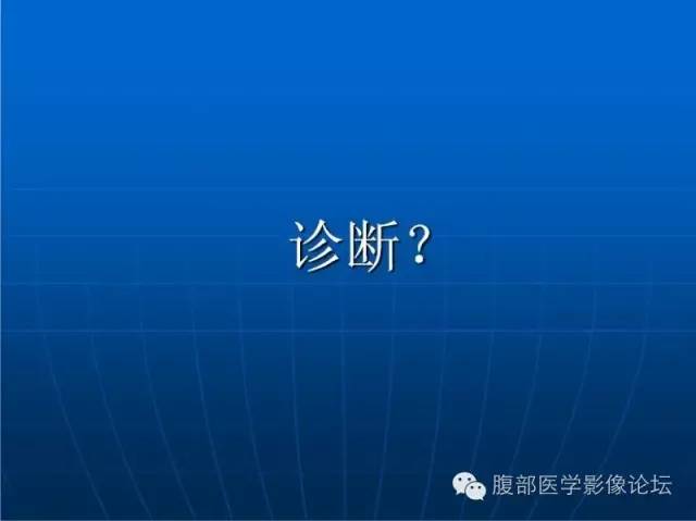【病例】右肾平滑肌瘤1例CT影像表现 【病例】右肾平滑肌瘤1例CT影像表现