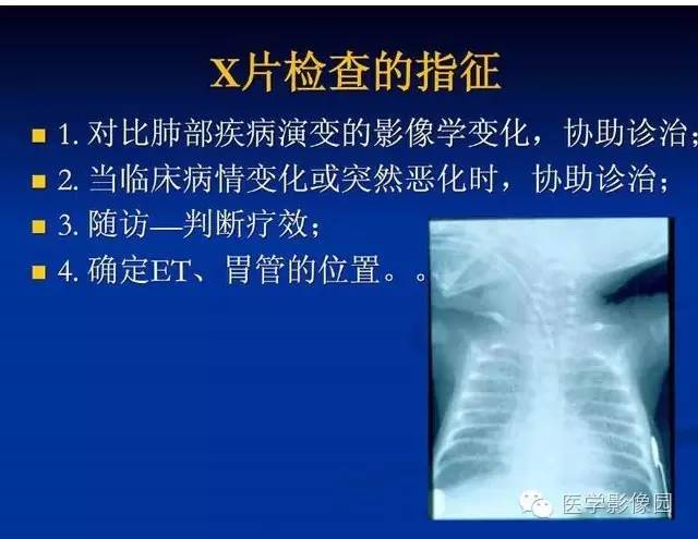 【PPT】新生儿肺部疾病影像学进展