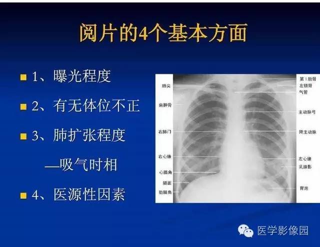 【PPT】新生儿肺部疾病影像学进展