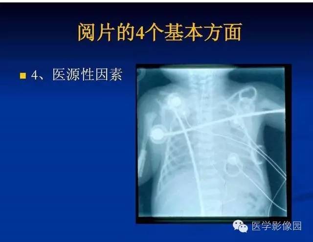【PPT】新生儿肺部疾病影像学进展