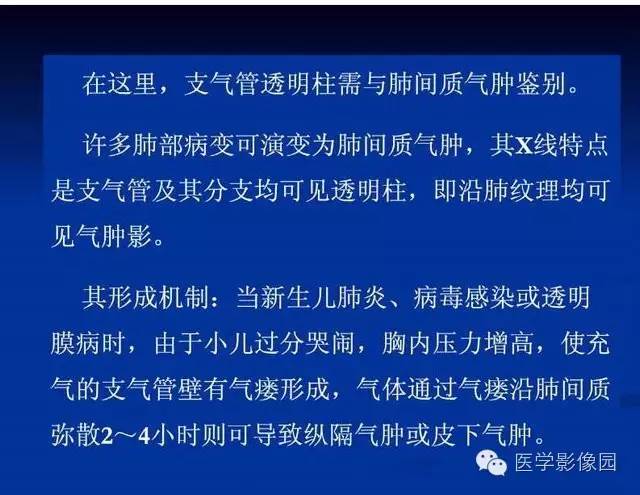 【PPT】新生儿肺部疾病影像学进展