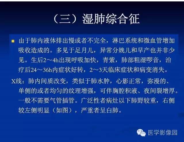 【PPT】新生儿肺部疾病影像学进展