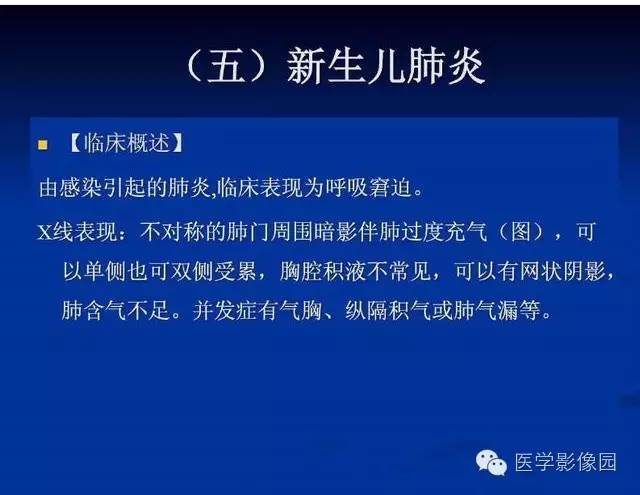 【PPT】新生儿肺部疾病影像学进展