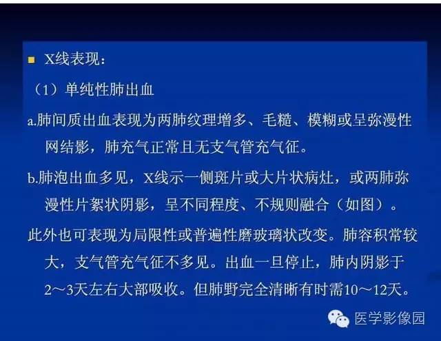 【PPT】新生儿肺部疾病影像学进展
