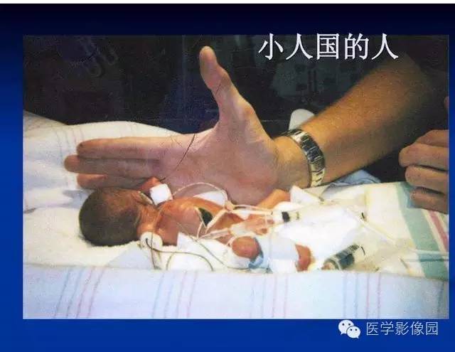 【PPT】新生儿肺部疾病影像学进展