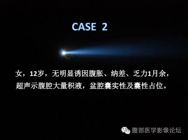 【病例】卵巢颗粒细胞瘤1例