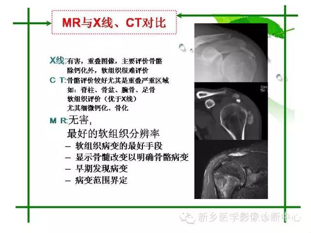 【PPT】CT和MR在骨与关节疾病的临床应用