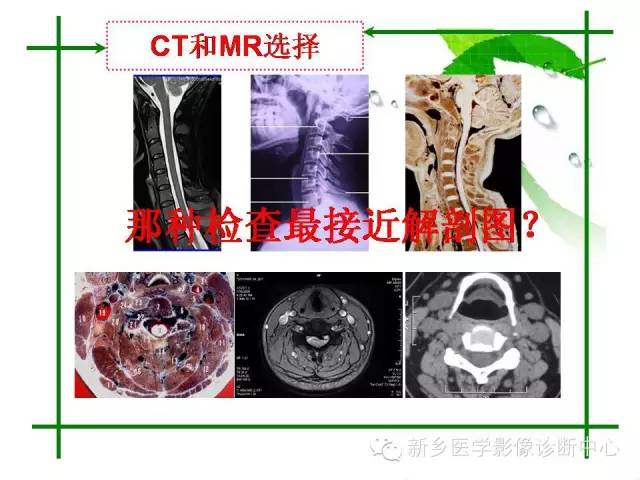 【PPT】CT和MR在骨与关节疾病的临床应用