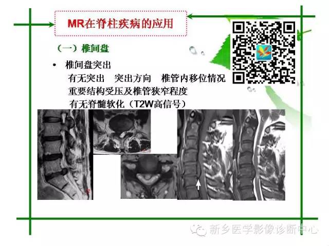【PPT】CT和MR在骨与关节疾病的临床应用