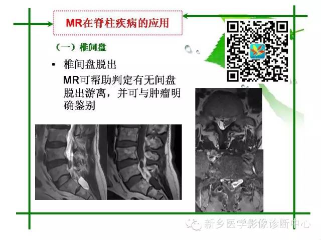 【PPT】CT和MR在骨与关节疾病的临床应用