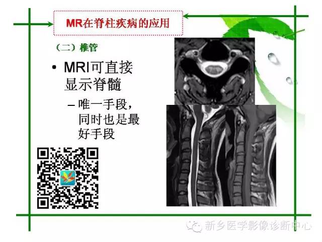 【PPT】CT和MR在骨与关节疾病的临床应用