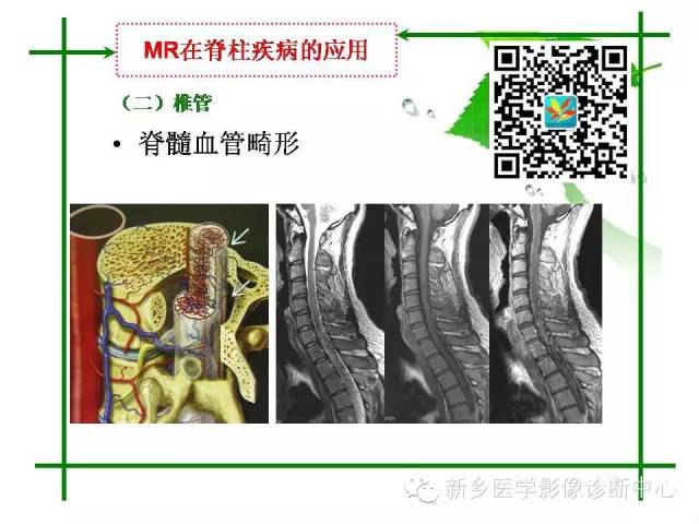 【PPT】CT和MR在骨与关节疾病的临床应用