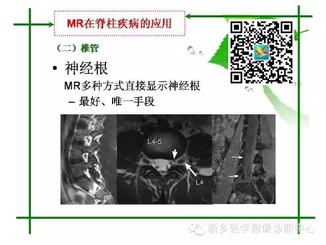 【PPT】CT和MR在骨与关节疾病的临床应用