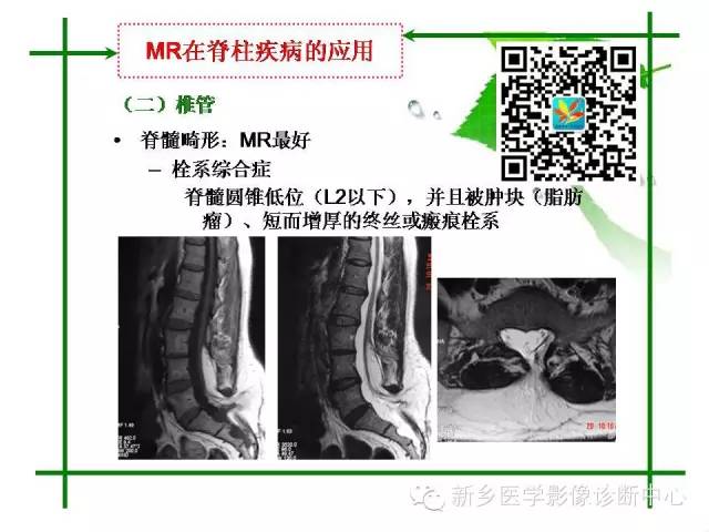 【PPT】CT和MR在骨与关节疾病的临床应用