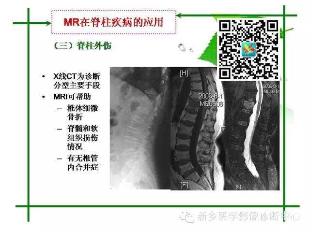 【PPT】CT和MR在骨与关节疾病的临床应用