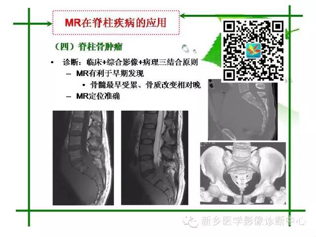 【PPT】CT和MR在骨与关节疾病的临床应用