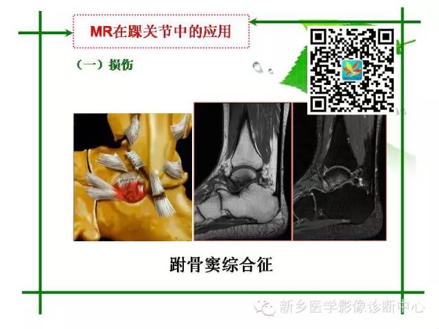 【PPT】CT和MR在骨与关节疾病的临床应用