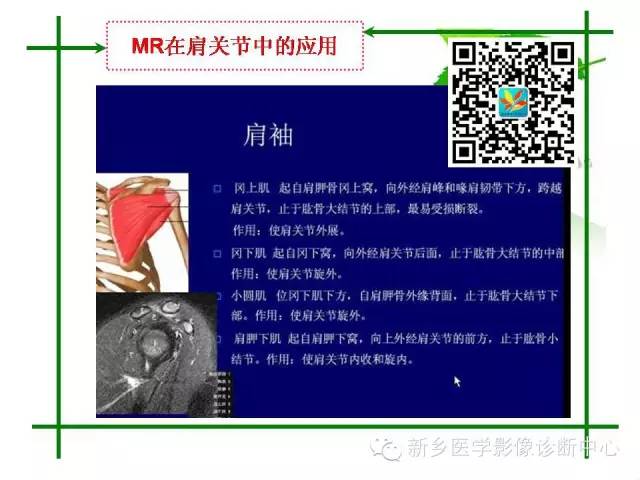 【PPT】CT和MR在骨与关节疾病的临床应用