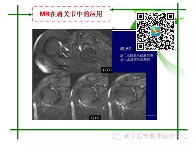 【PPT】CT和MR在骨与关节疾病的临床应用