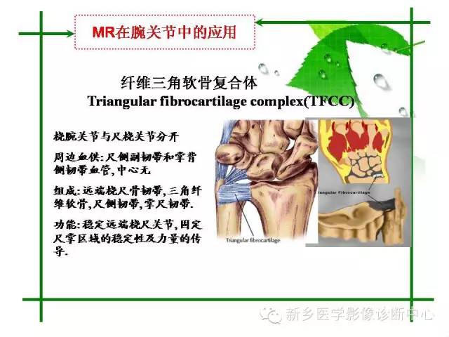 【PPT】CT和MR在骨与关节疾病的临床应用