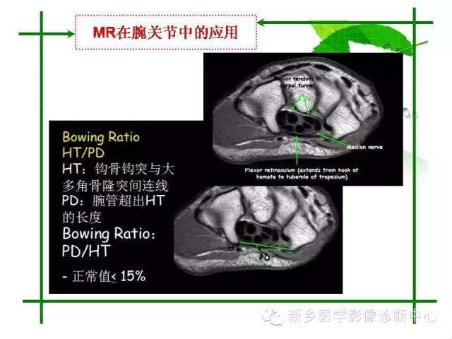 【PPT】CT和MR在骨与关节疾病的临床应用